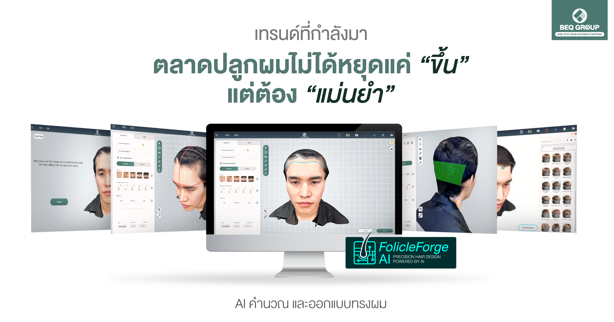 ภาพตลาดปลูกผมถาวรทั่วโลก