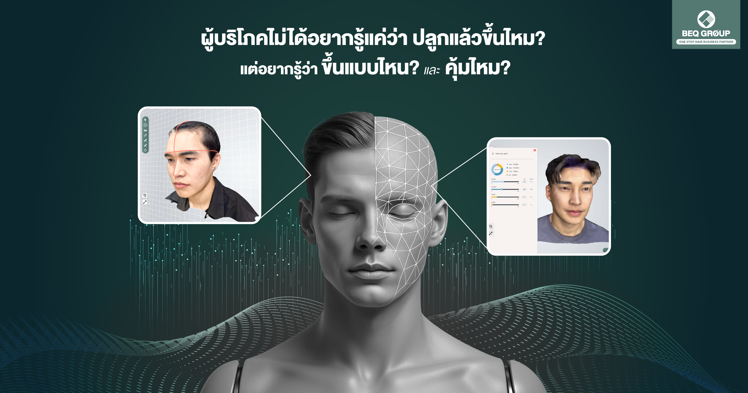 ภาพประกอบบทความพฤติกรรมผู้บริโภคกับการปลูกผม