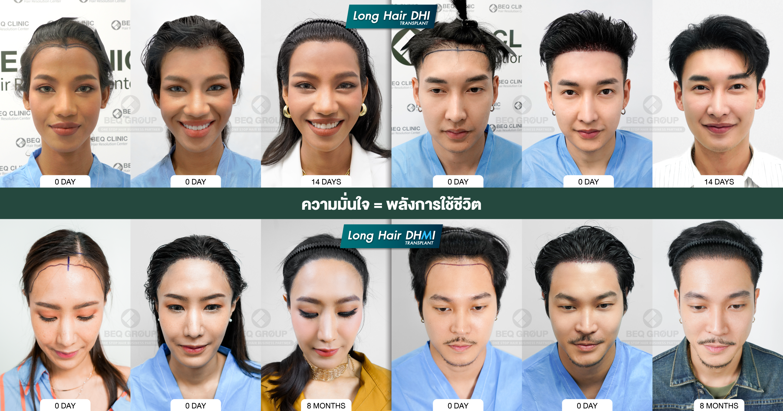 อินโฟกราฟิกผลกระทบผมร่วงต่อจิตใจ และโอกาสธุรกิจ